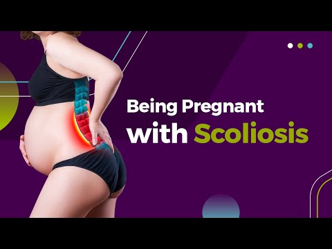 Being Pregnant With Scoliosis