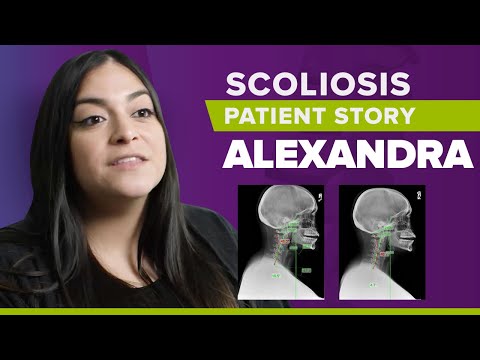 Cervical Kyphosis Treatment Success: Alexandra&#039;s Story