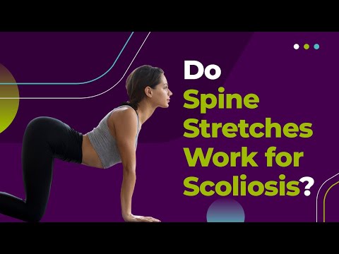 Do Spine Stretches Work for Scoliosis?