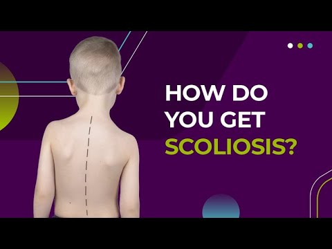 How Do You Get Scoliosis?