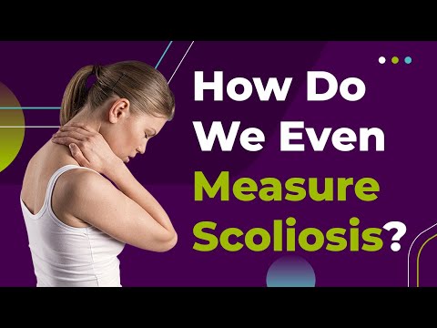 How Do We Even Measure Scoliosis?