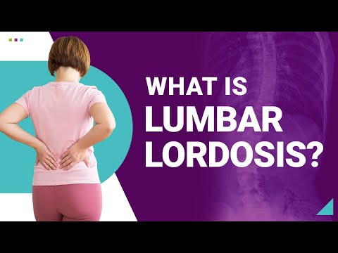 Lordosis (Swayback): Types, Causes & Symptoms