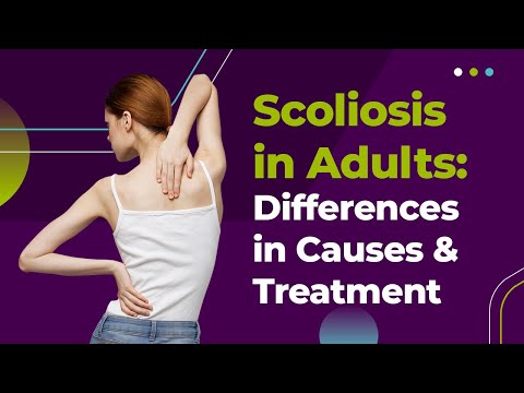 Scoliosis In Adults: Causes, Diagnosis and Treatment Options