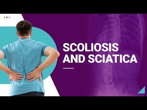 Scoliosis And Sciatica