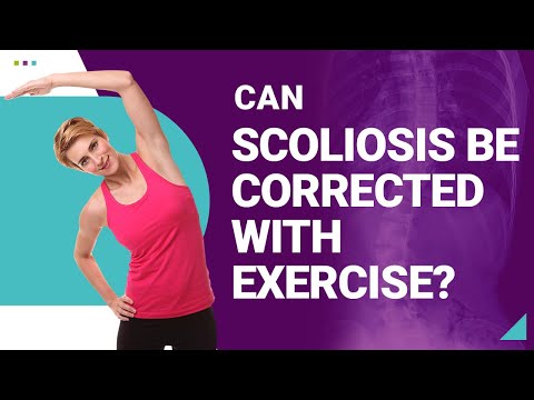 Can Scoliosis be Corrected with Exercise?