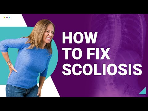 How To Fix Scoliosis