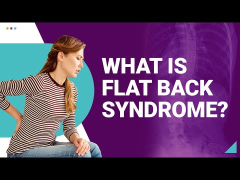 What is Flat Back Syndrome?