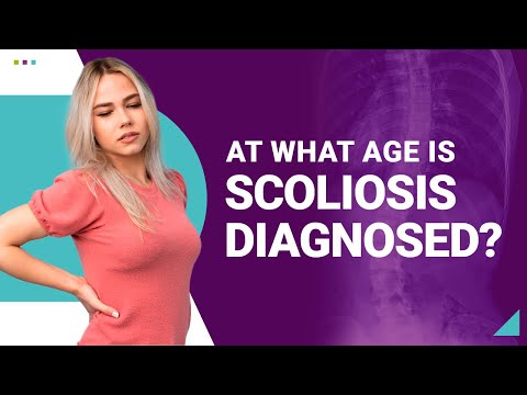 At What Age is Scoliosis Diagnosed?