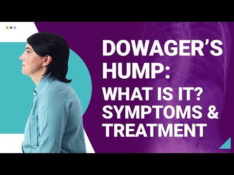 Humpal Chiropractic - Dowager's Hump: What is it? Can I prevent it?