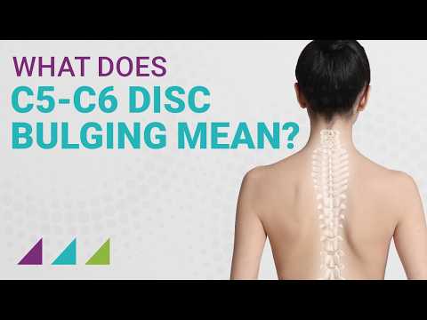 What Does C5-C6 Disc Bulging Mean?