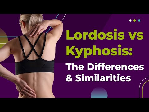 Lordosis vs Kyphosis: The Differences &amp; Similarities