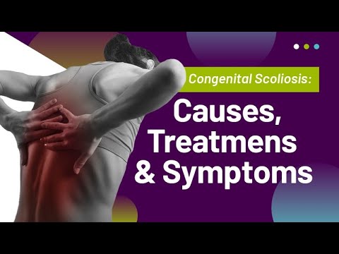 Congenital Scoliosis: Causes, Treatment, &amp; Symptoms