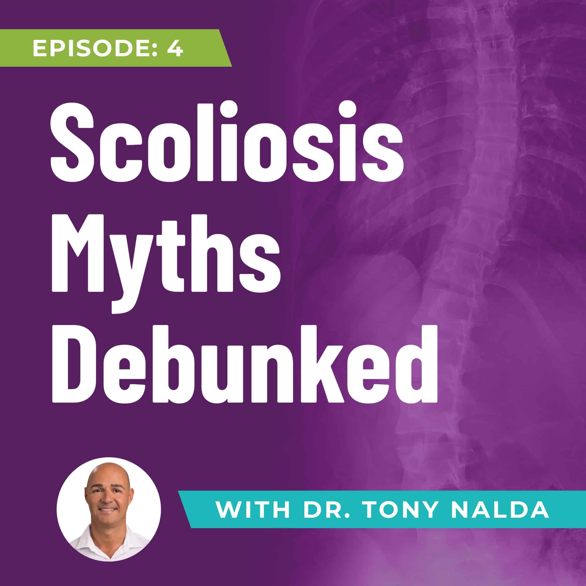 4 Scoliosis Myths Debunked