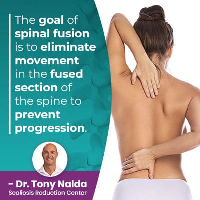 the-goal-of-spinal-fusion-400
