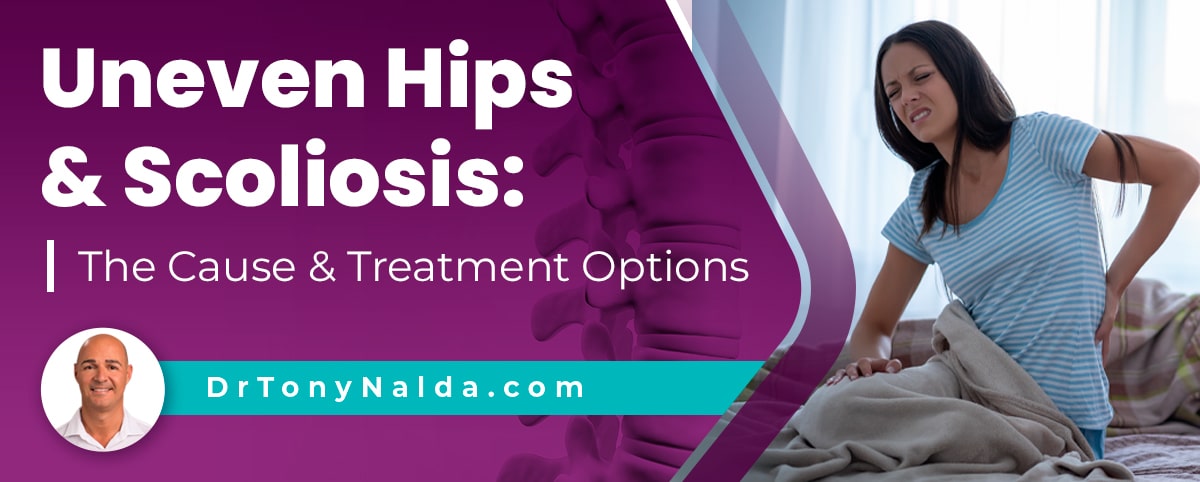 Uneven Hips & Scoliosis: The Cause & Treatment Options
