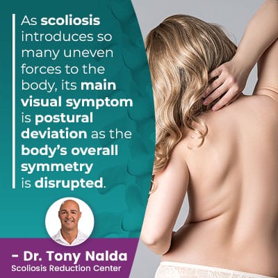 as-scoliosis-introduces-so-400