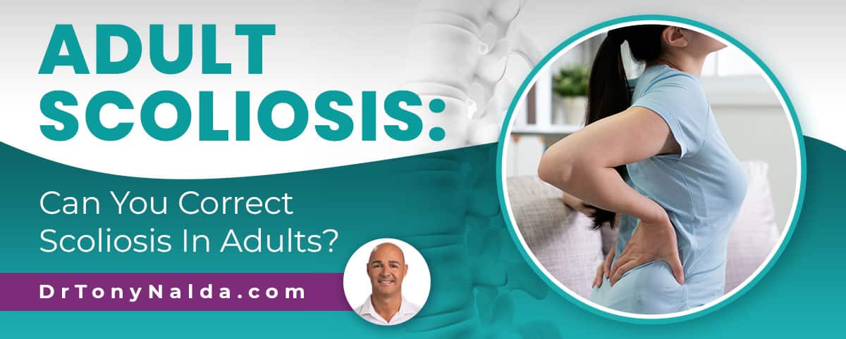 can you correct scoliosis in adults