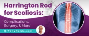 Cd Harrington Rods Harrington Rod for Scoliosis: Complications, Surgery, & More