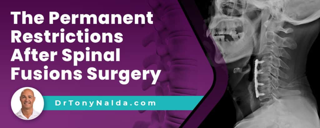 The Permanent Restrictions After Spinal Fusions Surgery