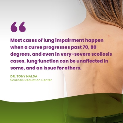 Most cases of lung