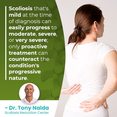 Scoliosis that's mild at 