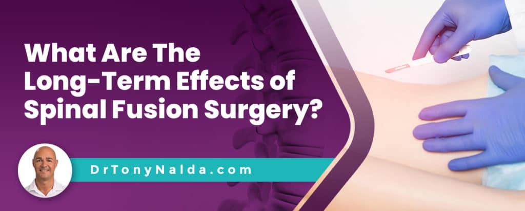 What Are The Long-Term Effects of Spinal Fusion Surgery?