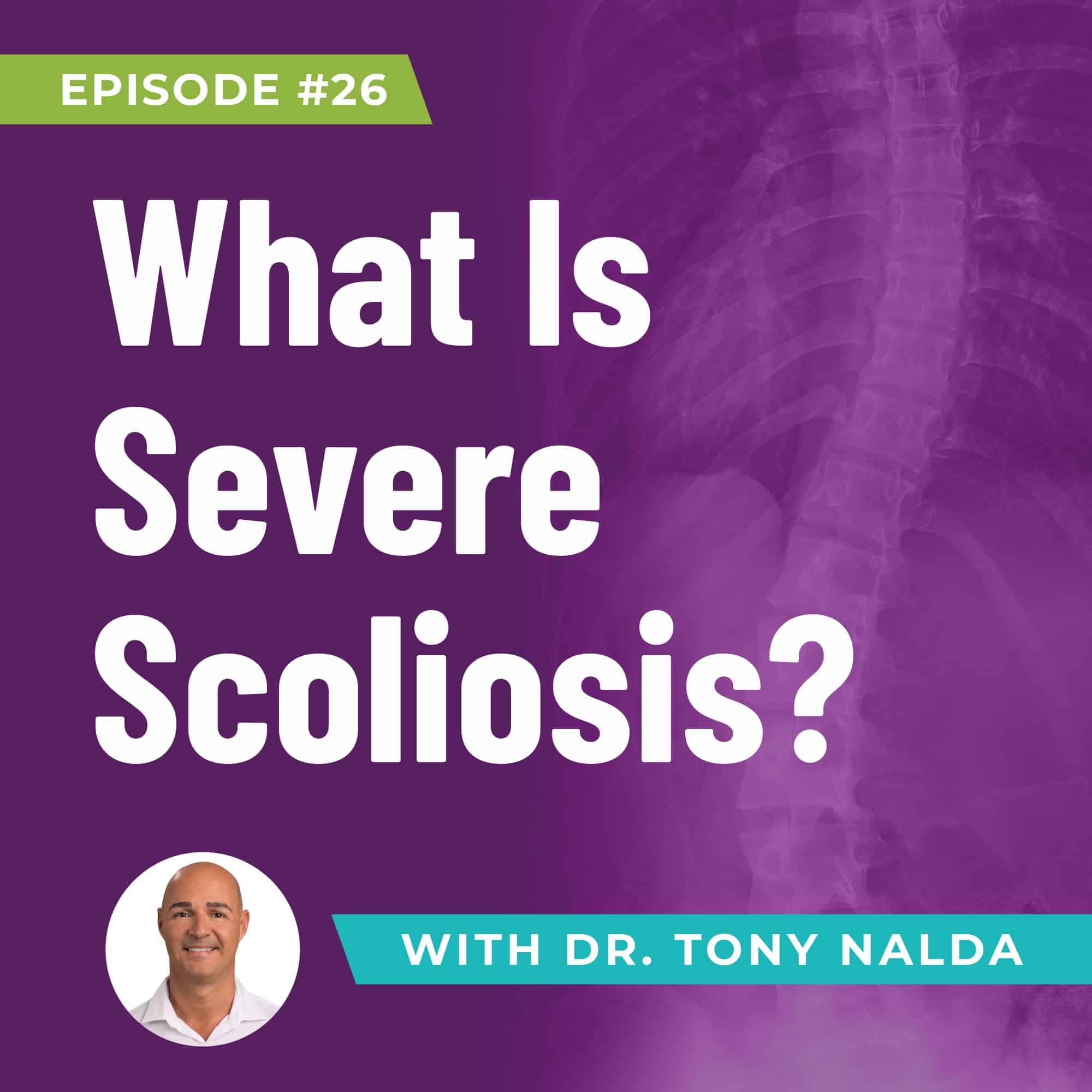 ep 26 What Is Severe Scoliosis