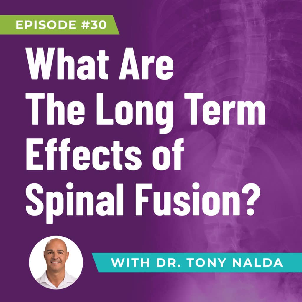 episode-30-what-are-the-long-term-effects-of-spinal-fusion