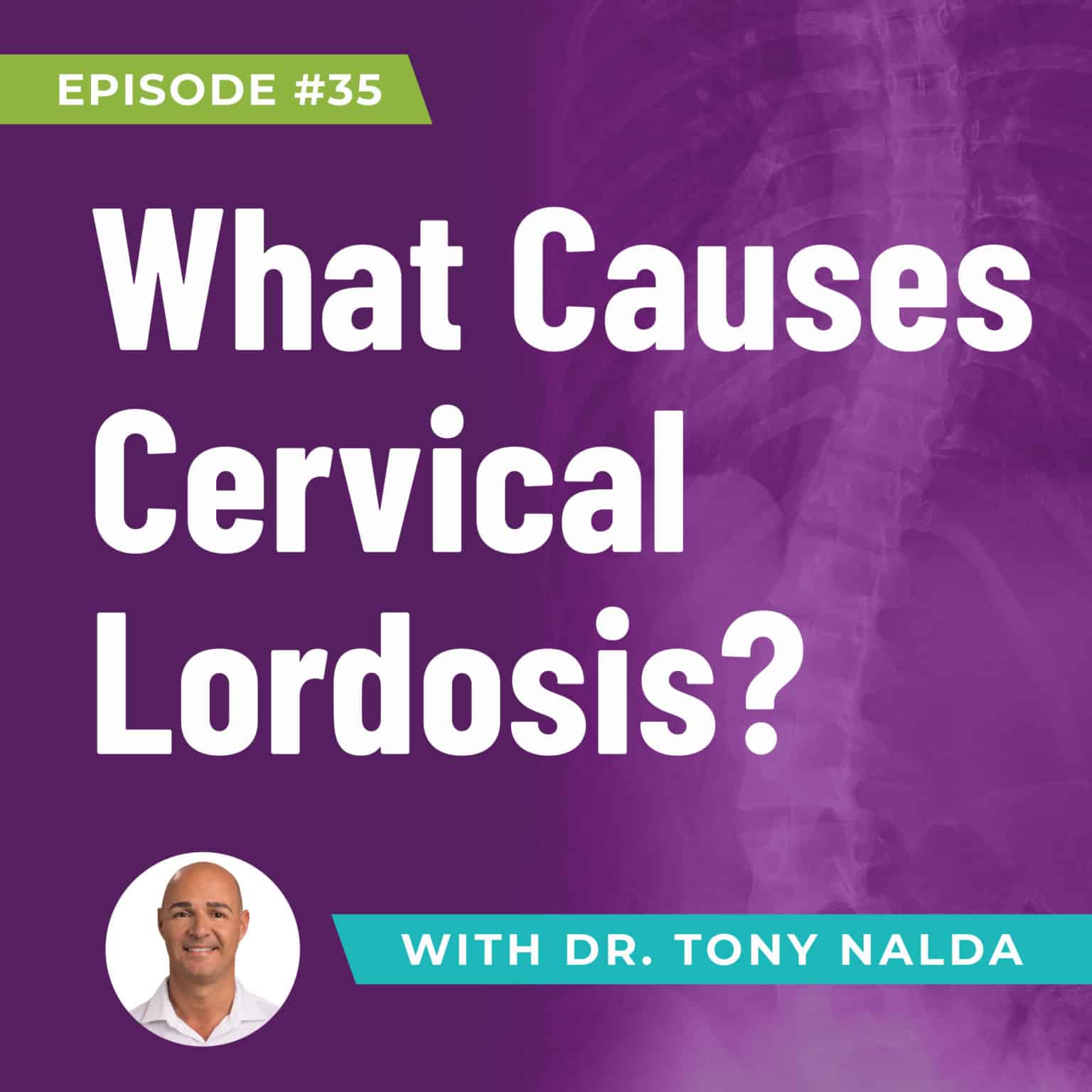 Episode 35 What Causes Cervical Lordosis