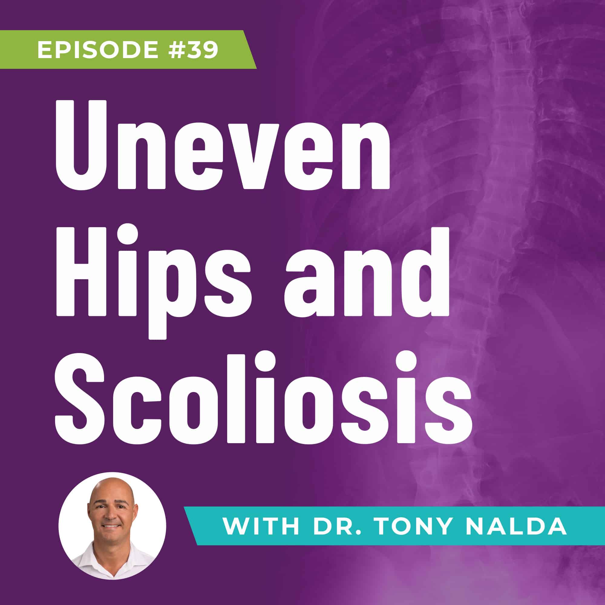 ep 39 Uneven Hips and Scoliosis