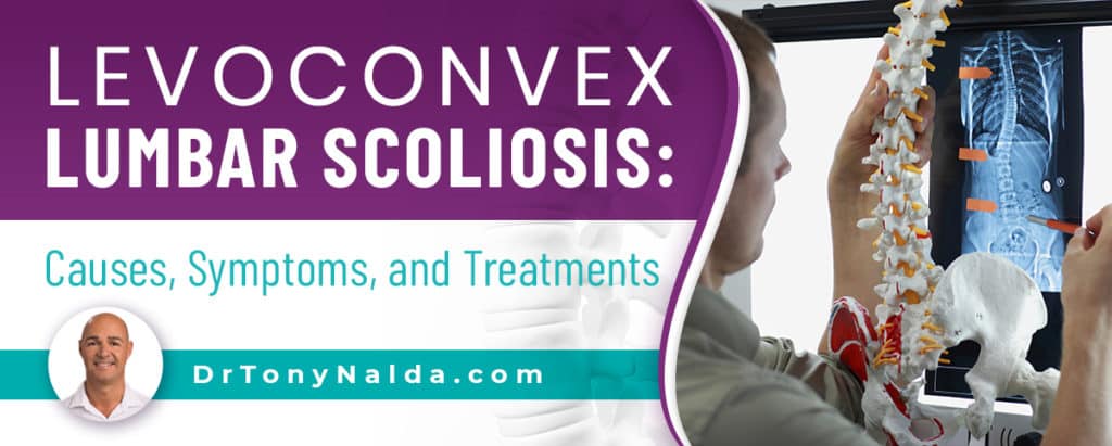 Levoconvex Lumbar Scoliosis: Causes, Symptoms, & Treatment