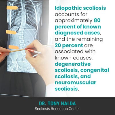 Idiopathic scoliosis accounts for approximately