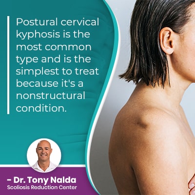 Postural cervical kyphosis is the
