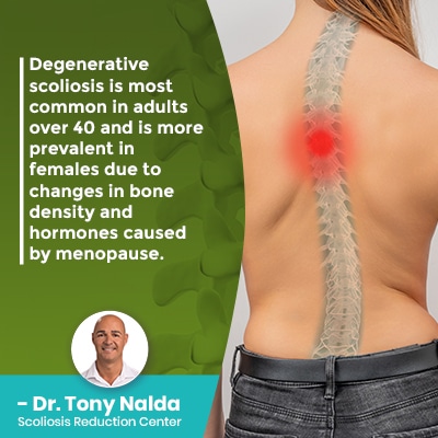 Degenerative scoliosis is most