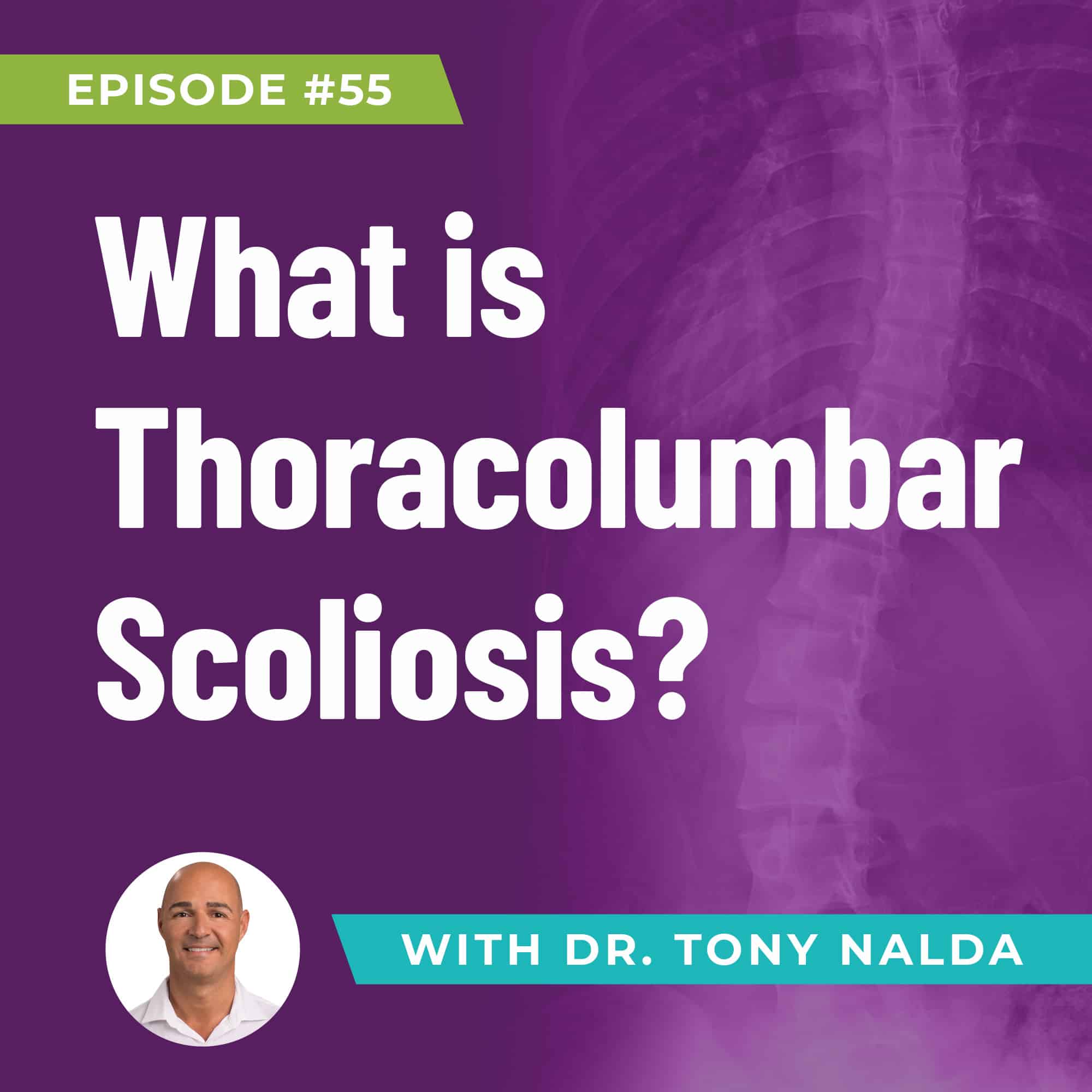 What is Thoracolumbar Scoliosis?