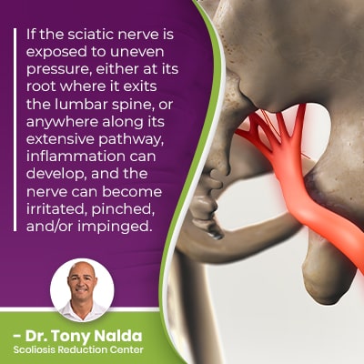 If the sciatic nerve is