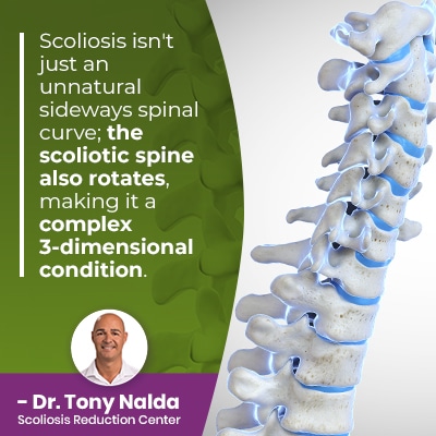 Scoliosis isn't just an unnatural