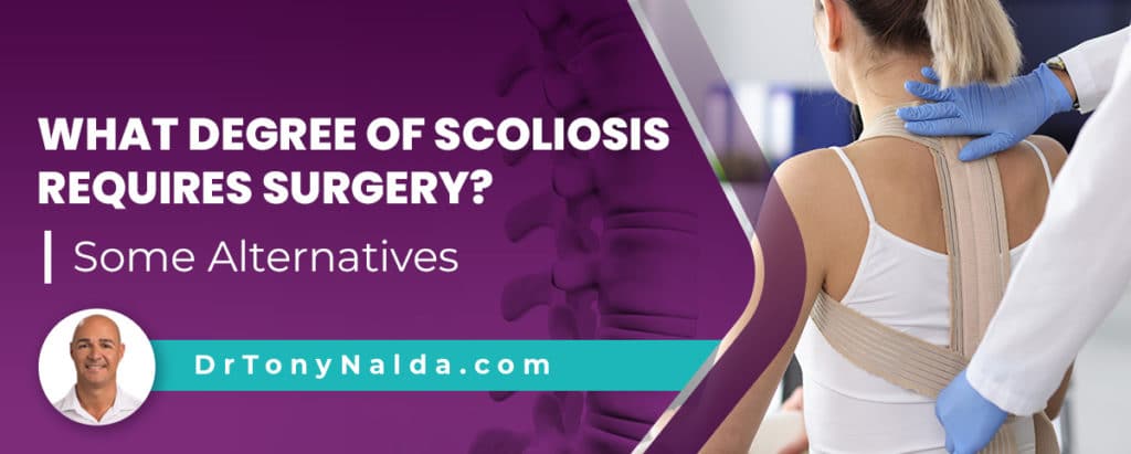 What Degree of Scoliosis Requires Surgery? Some Alternatives