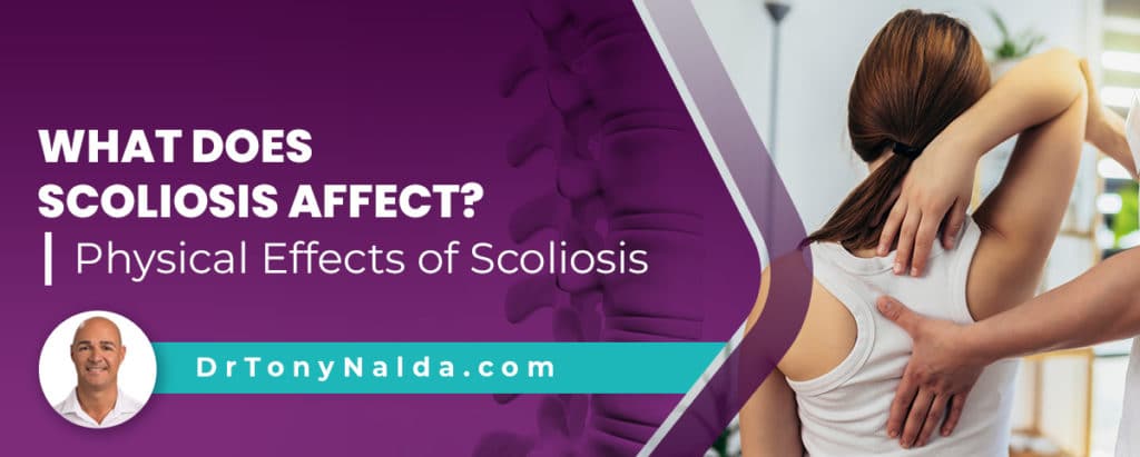 What Does Scoliosis Affect? Physical Effects of Scoliosis