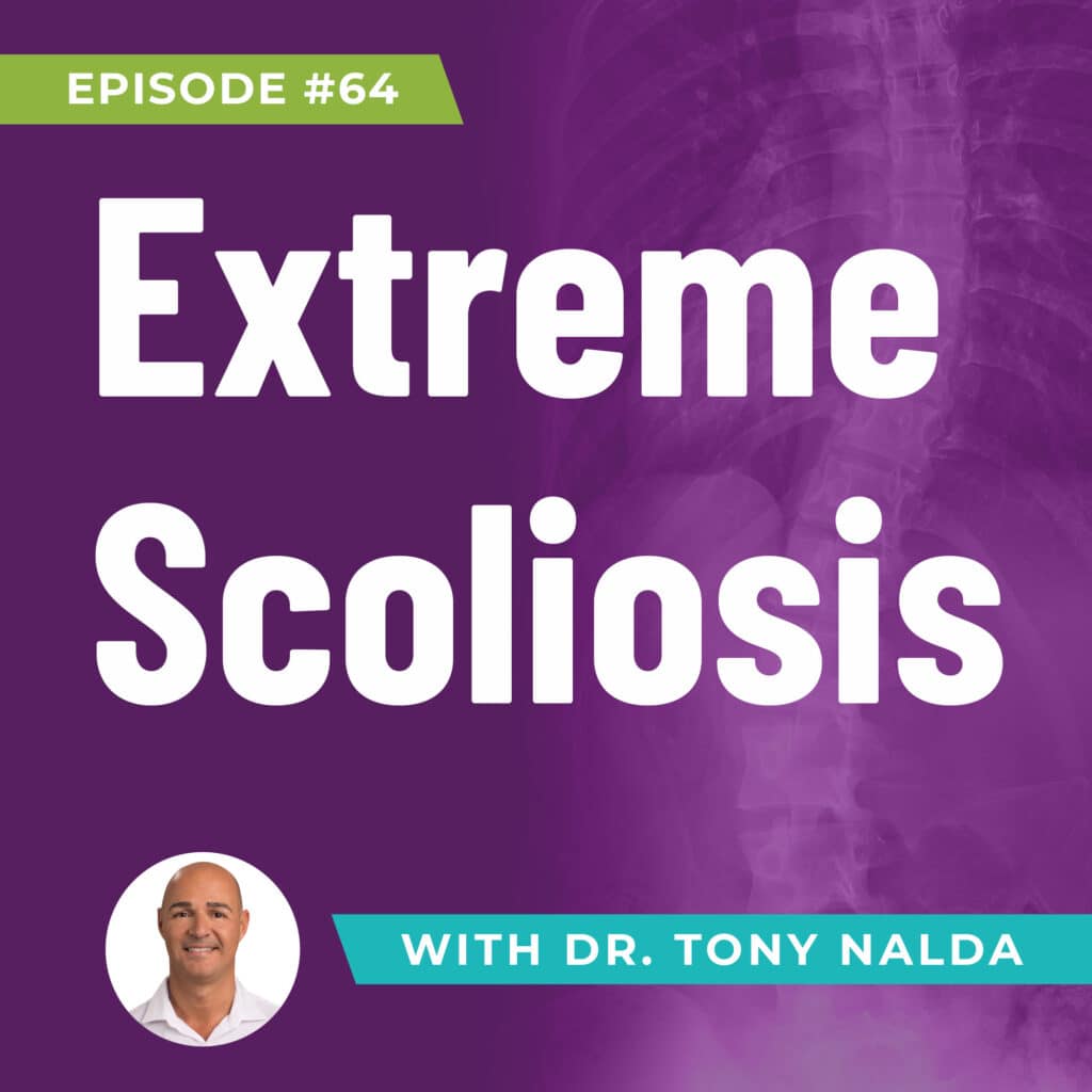 Episode 64: Extreme Scoliosis