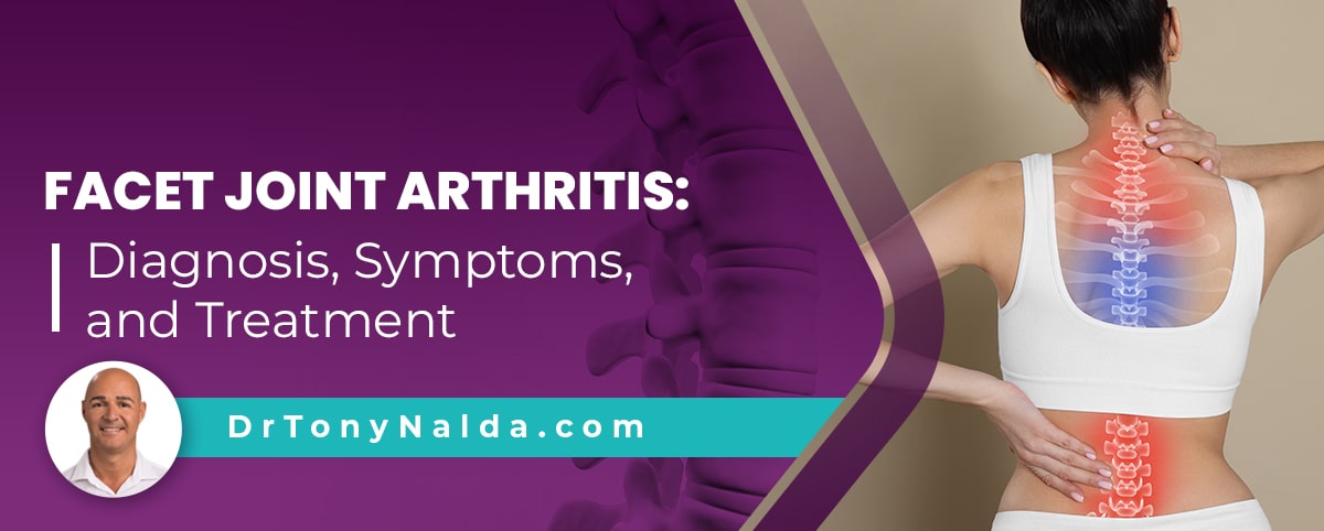 Facet Joint Arthritis Diagnosis, Symptoms, and Treatment