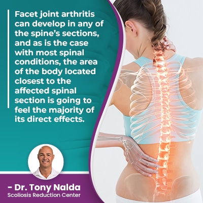 Facet joint arthritis can develop