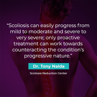 Scoliosis can easily progress from