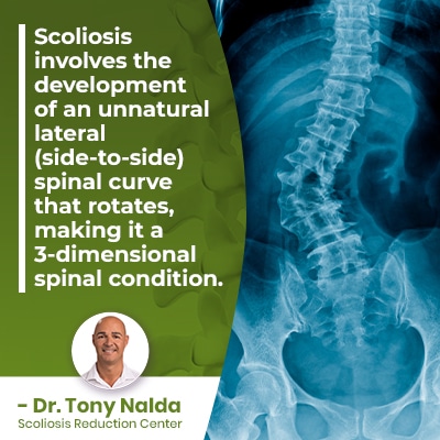 Scoliosis involves the development of