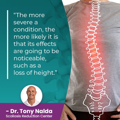 Can Scoliosis Affect My Height? Does It Make You Shorter?