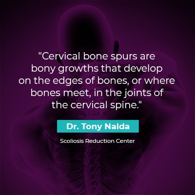 Cervical bone spurs are bony