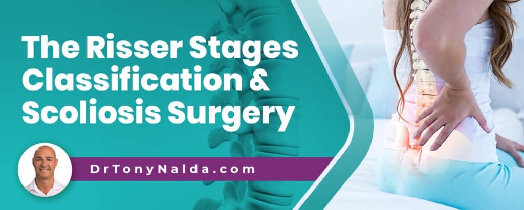 The Risser Stages Classification & Scoliosis Surgery