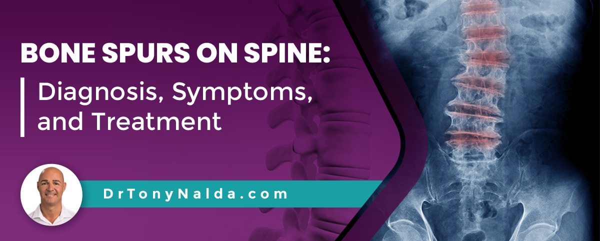 Bone Spurs On Spine Diagnosis, Symptoms, and Treatment