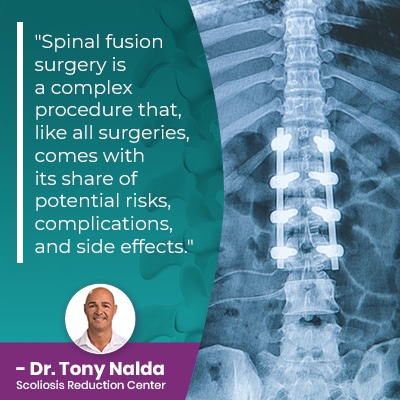 Spinal fusion surgery is a complex