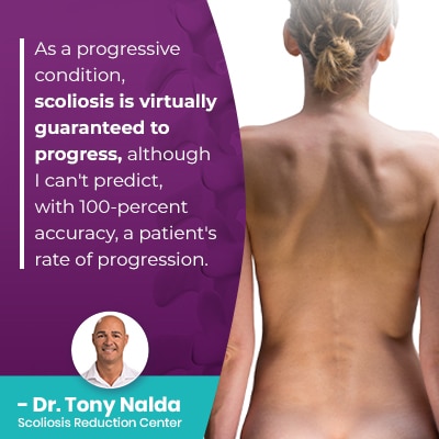 As a progressive condition, scoliosis